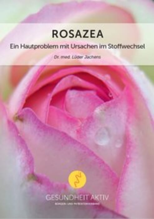 Rosazea